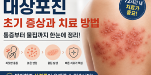 대상포진 초기 증상으로 나타나는 피부 발진과 물집 모습